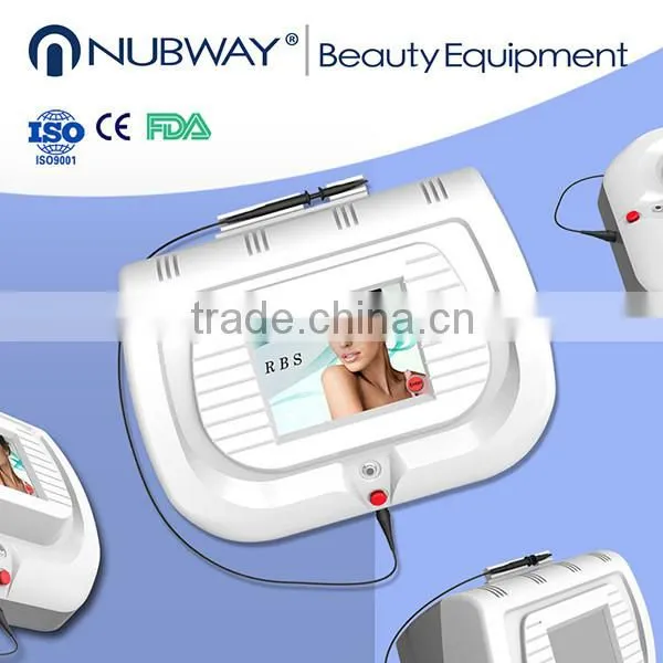 Thermal Coagulation Physiotherapy Spider Vein Therapy for Spider Vein Natural Treatment