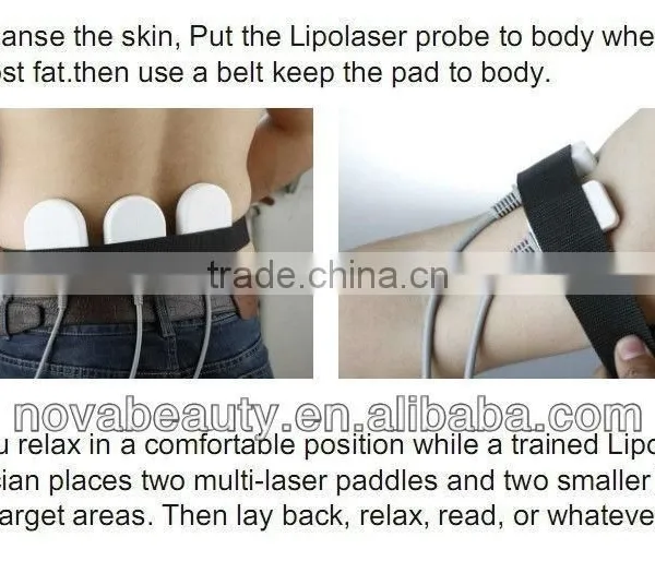 NV-650A Cold Laser Body Shaping System With 12 Pads photo-6