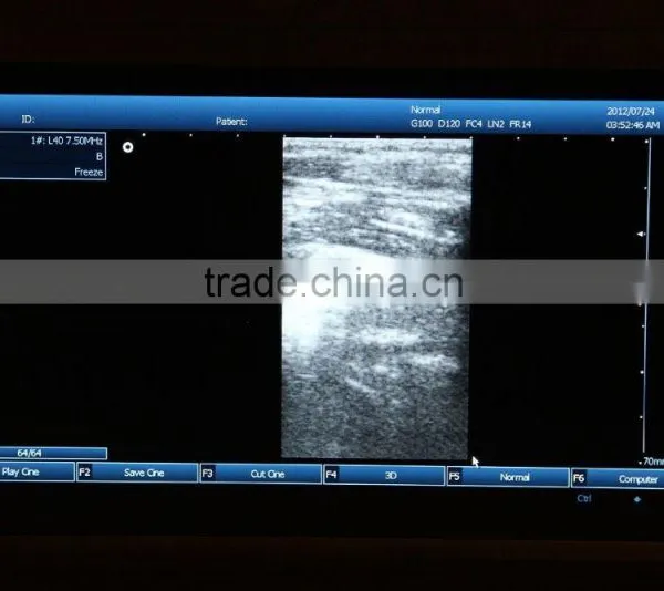 Laptop Ultrasound Scanner With 3D Function photo-2