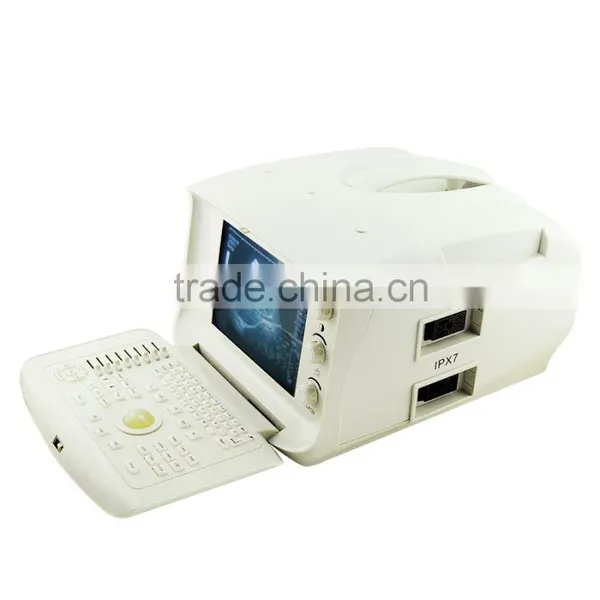 New Digital Portable Ultrasound Scanner With Low Price photo-2
