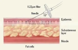 Hot in India Carboxy Treatment , Carboxy Treatment Equipment photo-6