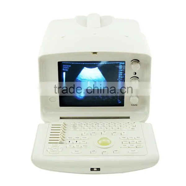 Carejoy Cheapest Portable Ultrasound Machine With Multi Frequency Probe SONY UP-898MD Video Thermal Recorder Optional photo-2
