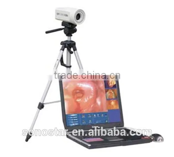 SVC-50 Colposcope(10)