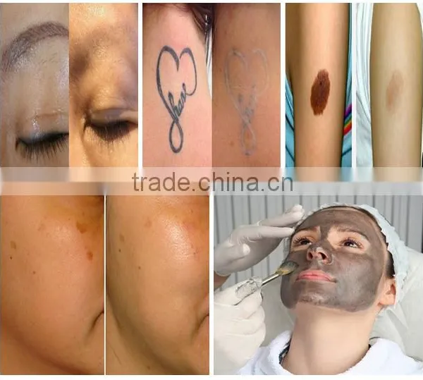 NEW Technology High Power Hair Removal E-light Ipl rf nd Yag Laser Multifunction Machine photo-5