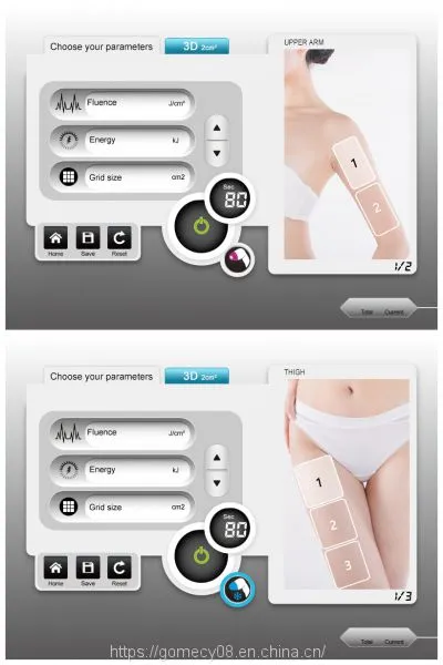 Alma Laser Soprano Platinum 808nm 755nm 1064nm Diode Laser Hair Removal Technology photo-5