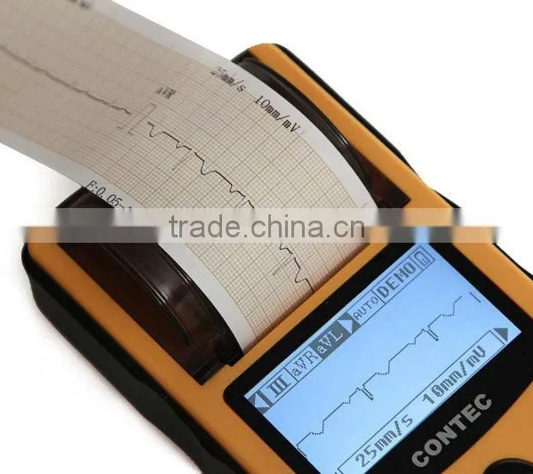 OEM/ODM Supply Digital 1-channel Handheld Electrocardiograph Portable Factory Price of Ecg Machine photo-5