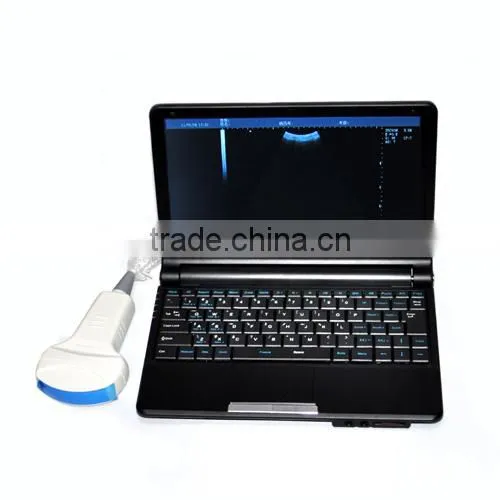 VET Ultrasonic Veterinary Ultrasound Machine / Scanner With 3.5MHz Convex Probe RUS-9000V photo-4