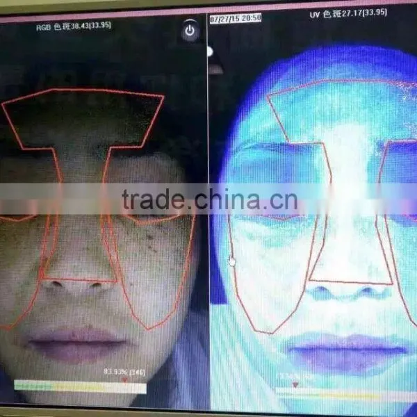 3D Facial Skin Analyzer for Skin Spots Wrinkle Pore Skin Color Analysis P-105B photo-3