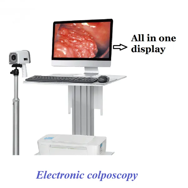 High Definition Digital Electronic Colposcope photo-2