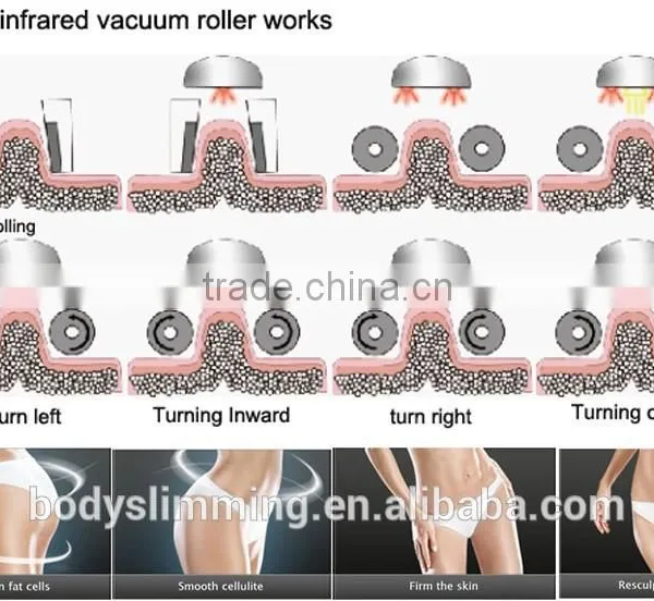 Vacuum Roller Body Facial Vacuum Suction Machine photo-5