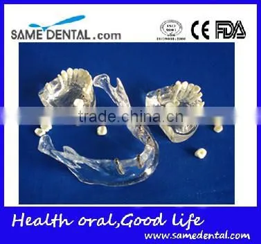 Hot Sale Transparant Mandibule Implant Model photo-3