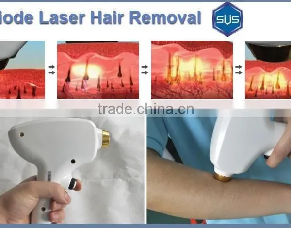 Latest Technology 808nm Diode Laser Hair Removal Home Machine photo-5