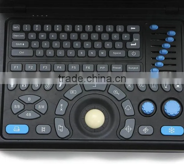 High Quality Cheap Price of Portable/Notebook/Laptop Ultrasound Scanner/machine With Convex, Linear, Vaginal, Rectal Transducer- photo-6