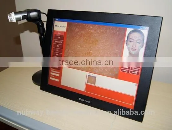 Professional Made in Taiwan Skin Magnifier Portable Skin Analysis Equipment photo-3