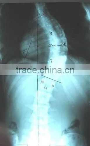 medical thermal x ray film,blue sexy film ,medical lab analyzers