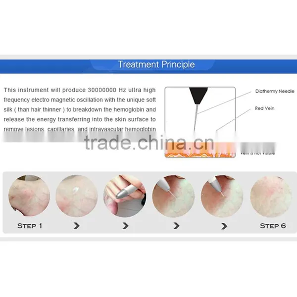 30MHz RBS Beauty Machine Coagulation Vessels Laser Blood Vessel Removal Device photo-6