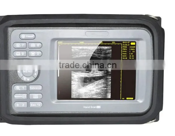 Carejoy Handheld Ultrasound Scanner HandScan H8 With 3.5 Mhz Convex Probe Suitable Carry/transporation Good Price photo-3