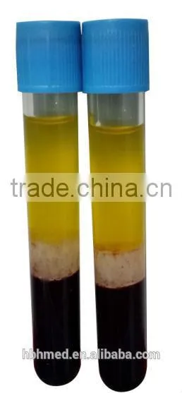 Non-pyrogenic Platelet Rich Plasma Prp Kit Easy photo-2