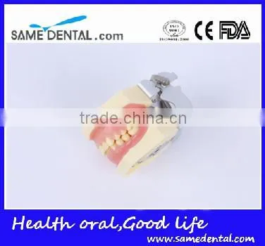 Dental Moderate Periodontal Disease Model Teaching Demonstration photo-4