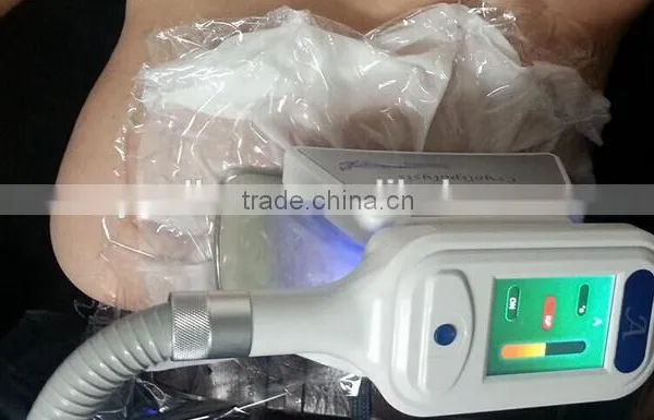 2016 Best Coolsculption Body Slimming Machine photo-5