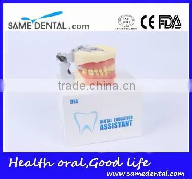 Dental Moderate Periodontal Disease Model Teaching Demonstration photo-6