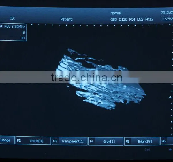 Vet Used 3D Full Digital Portable Ultrasound Scanner Suitable for the Big Animals and Small Animals photo-3