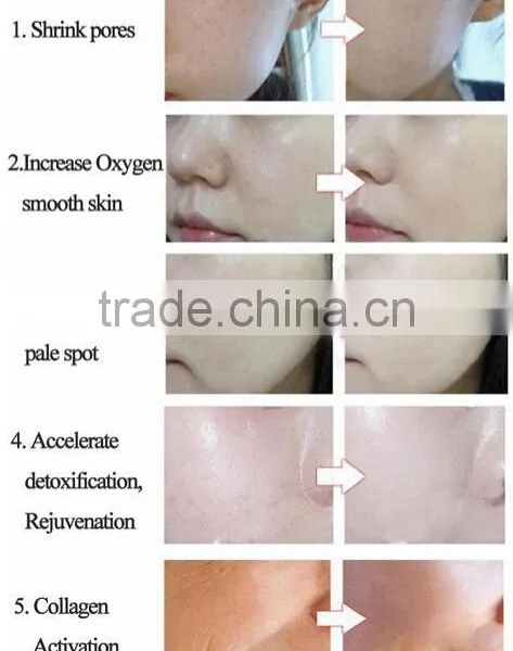 2016 Korea Stype LED Mask Neck Photon / LED Facial Mask / PDT Lamp photo-6