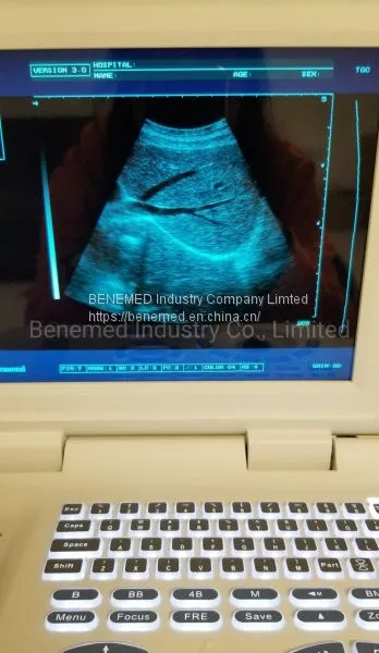 Notebook Type Black and White Ultrasound Scanner Medical Equipment photo-2