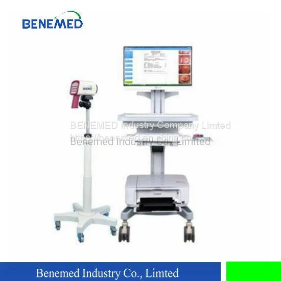 Medical Equipment Digital Video Colposcope for Gynecology photo-2