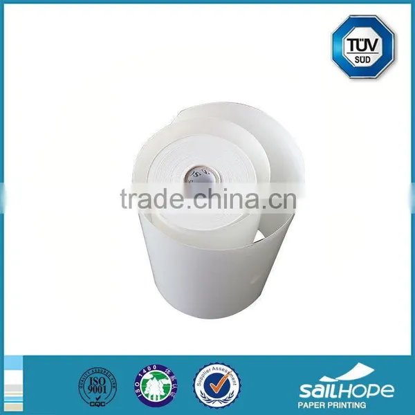 Contemporary Exported Custom Ecg Paper Rolls photo-2