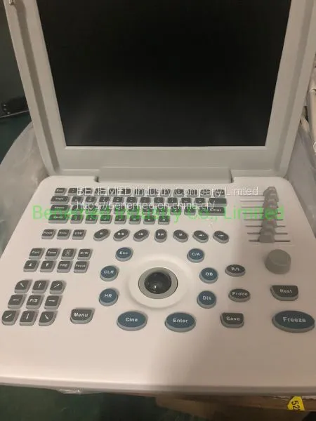 Portable B/W Ultrasound Scanner With Clear Image Quality Hospital Equipment photo-3