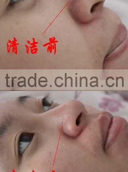 New Updated Exfoliators Machine Water Microdermabrasion/facial Cleaning Brush photo-5