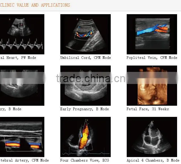 Trolley 3D/4D Color Doppler Ultrasound Diagnostic System I3 With CE Certificate photo-2