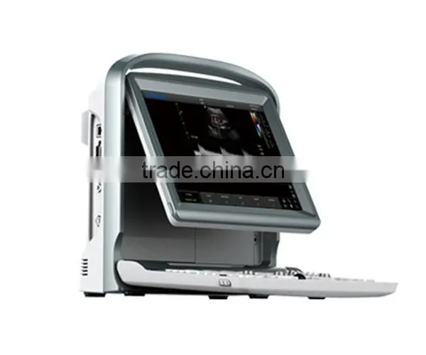 Medical Equipment 18 Months Warranty Ultrasound Machine Color Doppler With Trolley photo-2