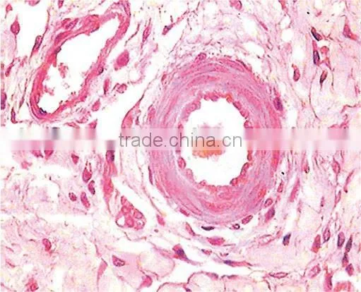 Lab and medical pathology microscope slides