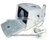 MCSS-6Portable Ultrasound Scanner Portable Ultrasound Machine Color Dopler photo-4
