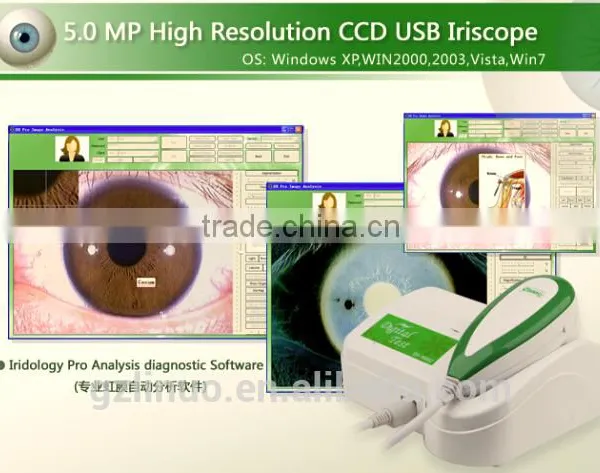 Hot Selling Iriscope Analyzer Iridology, Eye Iriscope Iris Analyzer Iridology