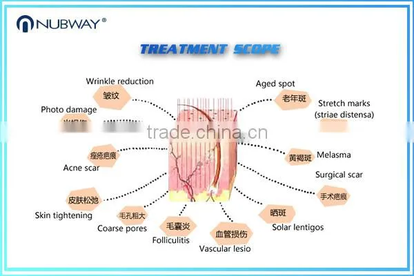 Skin Regeneration Stretch Mark Removal Hottest Sale !!!! Co2 Laser Remove Neoplasms 0.1-2.6mm Fractional Equipo Fractional Co2 Laser Acne Scar Removal Machine photo-2