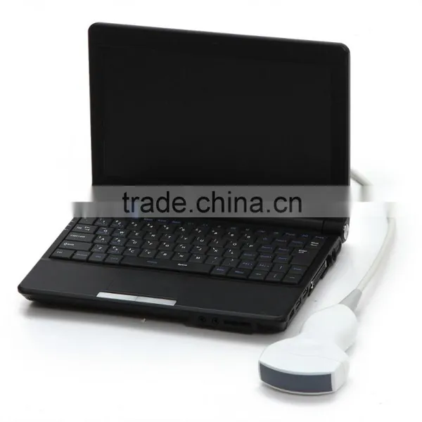 Clear Image Laptop Type Ultrasound Scanner System Full Digital Machine in Transport Carriage photo-5