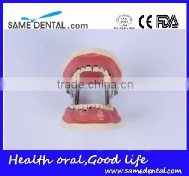 Dental Severe Periodontal Disease Model School Teaching photo-3