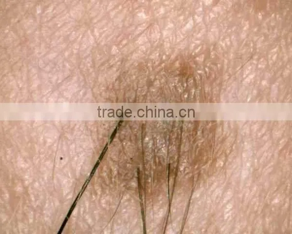 Portable Skin and Hair Analyzer Machine photo-3