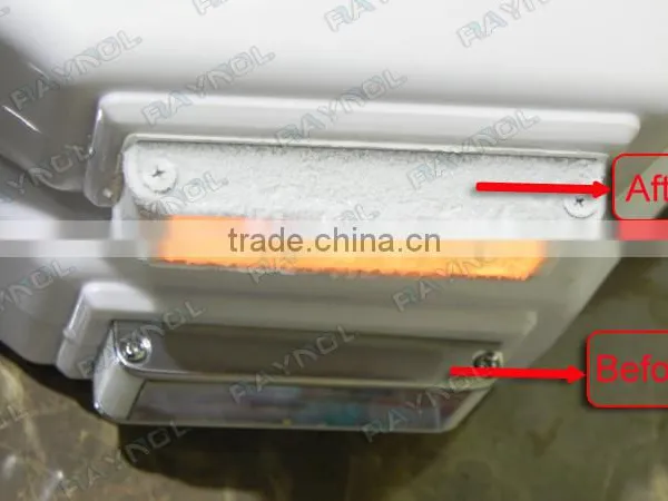 Companies Looking for Distributors Hair Removal Best IPL Machine photo-3
