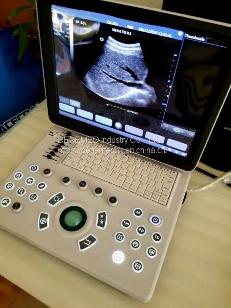 Ultraslim Notebook Type Black and White Ultrasound Scanner Machine photo-2