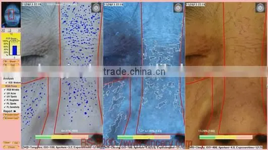 Portable Facial Skin Scanner Analyzer 3D Facial Skin Analysis photo-3