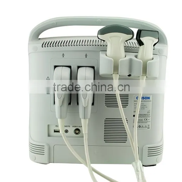 China Cheap Price USB Portable Laptop Color Doppler Ultrasound Scanner for Pregnancy Scanner Ultrasound photo-6
