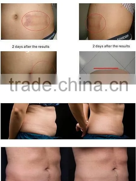 Best Multi Functional Machine With Tool New Chinese Slimming Equipment photo-2