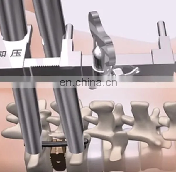 Spine Retractors, Neurosurgery Instruments, Spinal Surgery Distractor photo-4