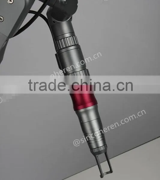 q Switch nd Yag Laser for Pigment Removal photo-3