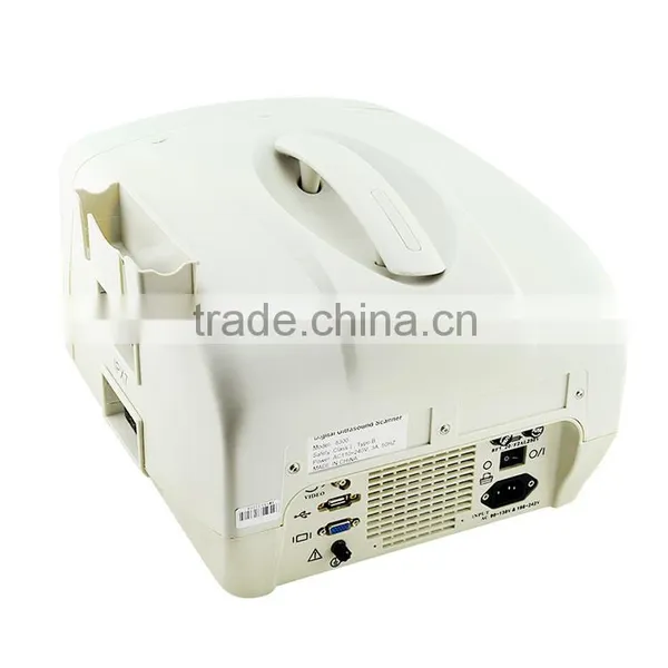 High Sensitivity Trolley Style Digital Portable Ultrasound Scanner With 2 Probe Connector photo-5