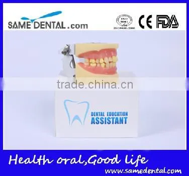 Dental Extraction Model School Teaching Model Teeth Model photo-5